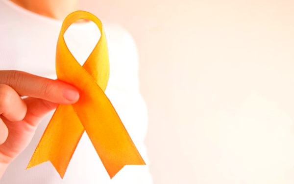 Agosto Laranja na Cunzolo Agosto Laranja na Cunzolo